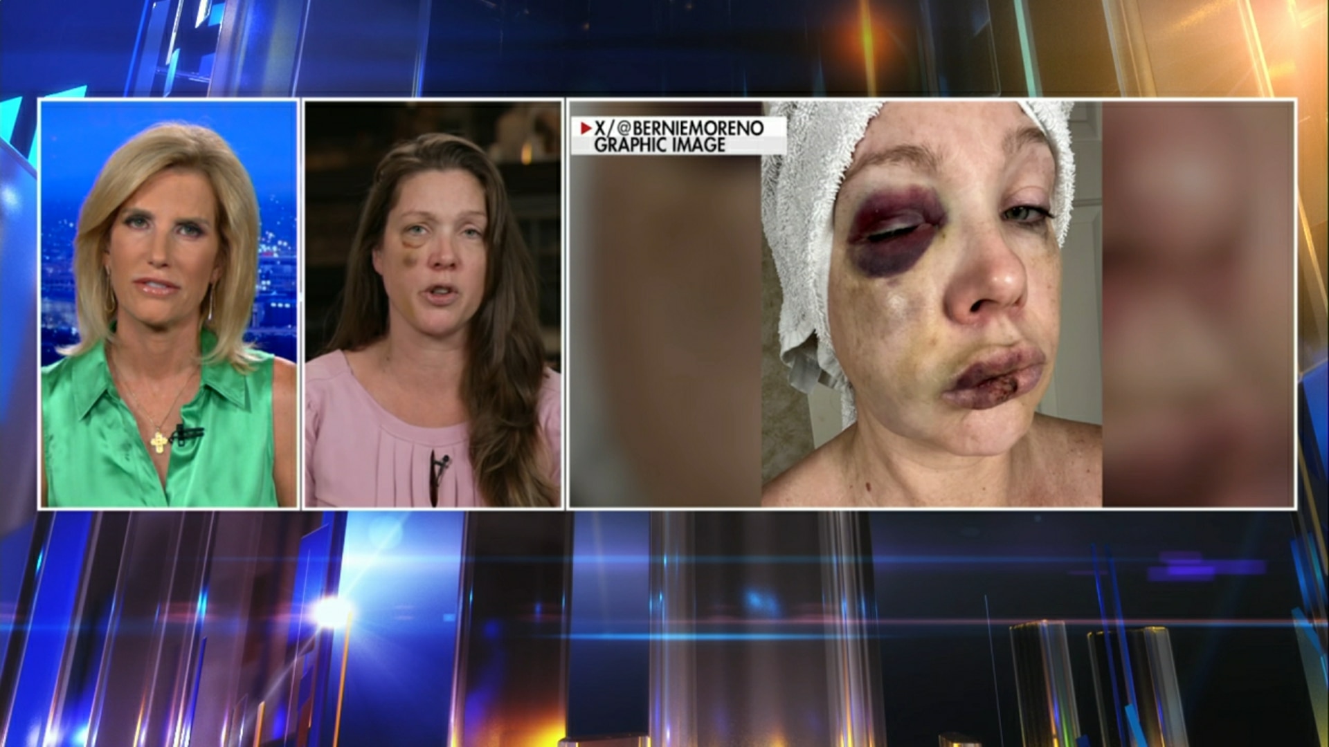 (8/7) An Ingraham Interview with Brawl Victim