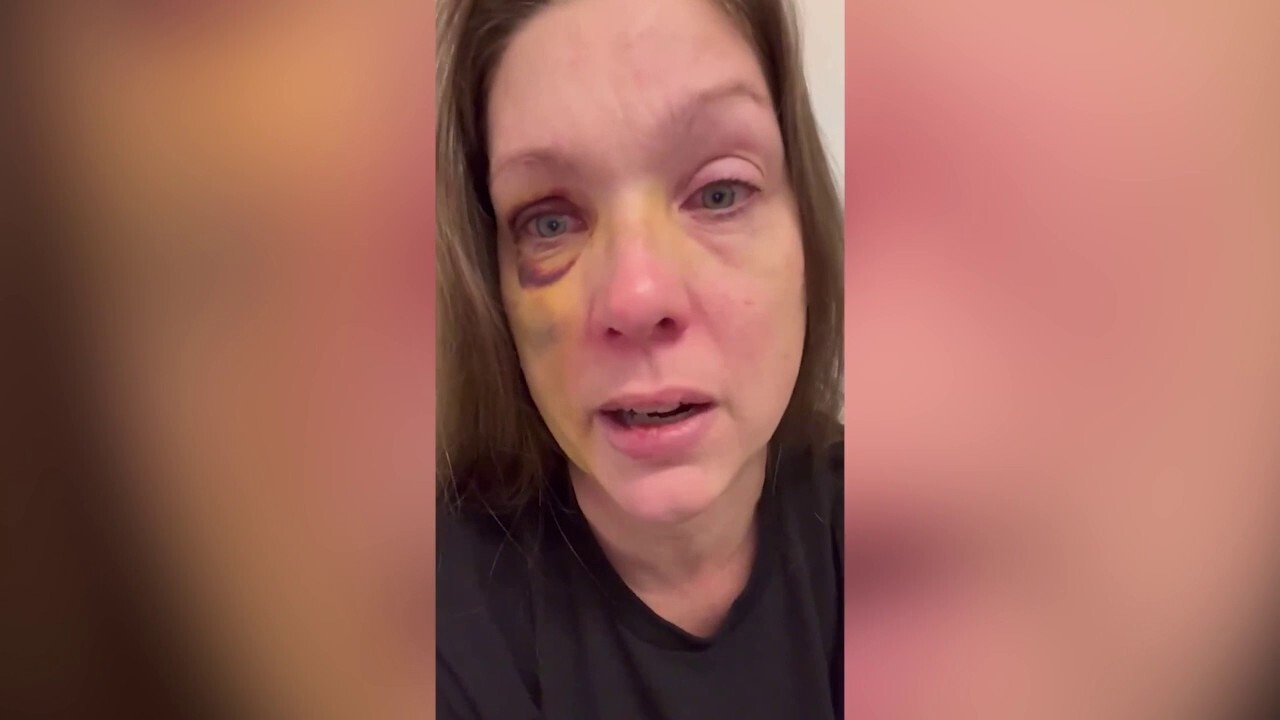 Cincinnati beating victim speaks out