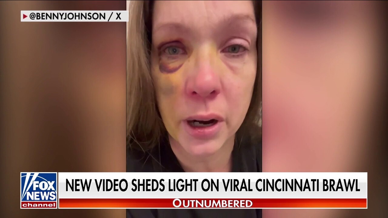 Cincinnati beating victim speaks out after brutal attack: 'Still recovering'