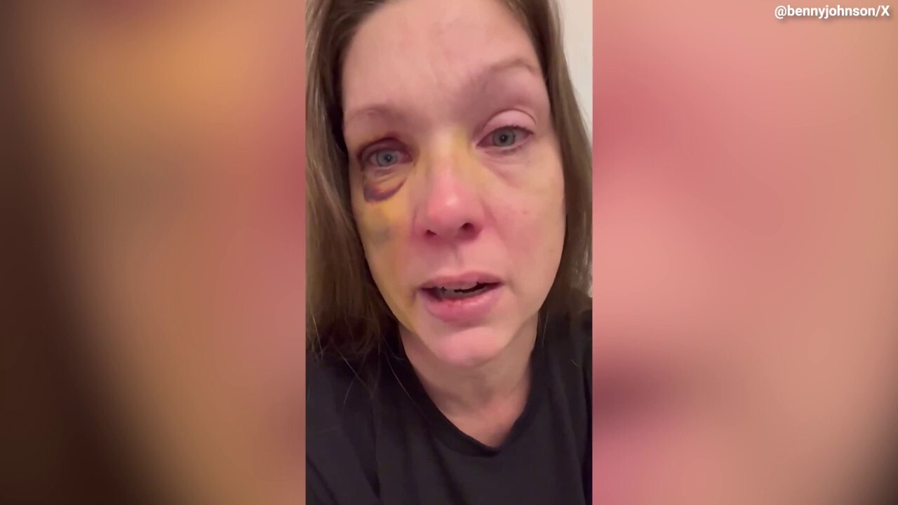 Cincinnati beating victim speaks out