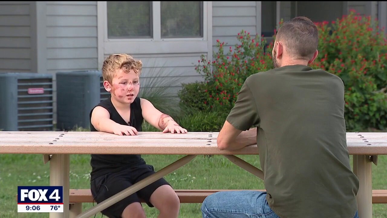 8-year-old boy speaks out following Fort Worth hit-and-run