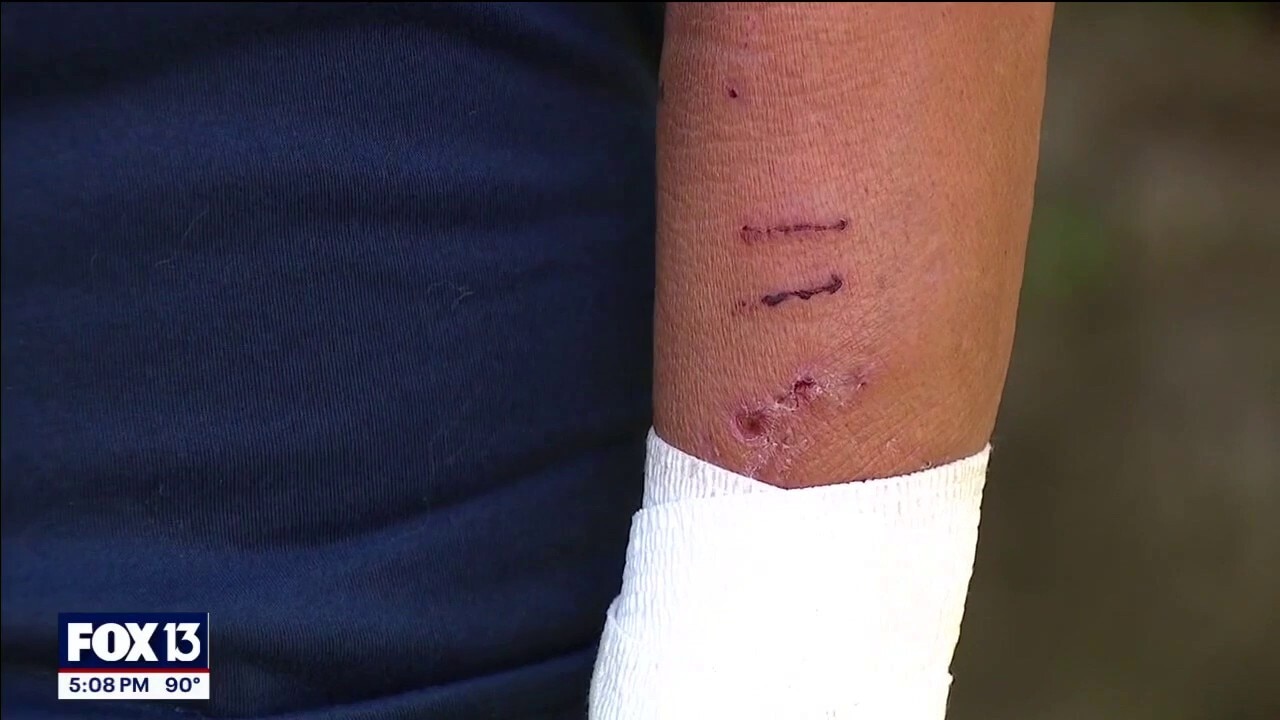 Florida woman saves self, dog from gator attack