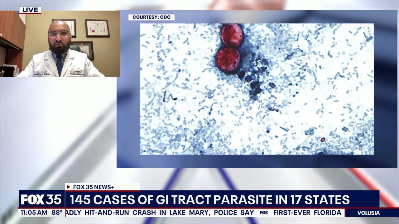 Expert safety tips for this GI parasite outbreak