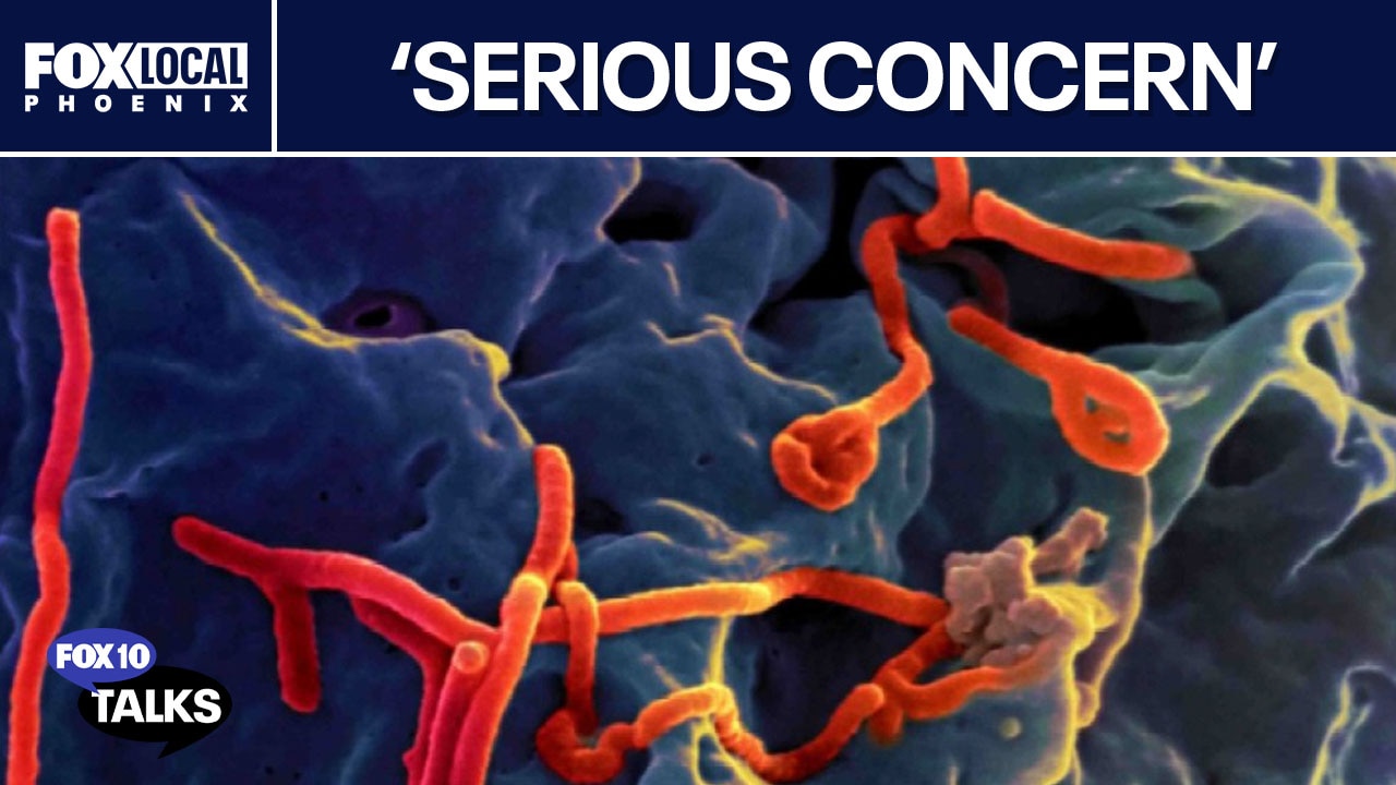 Ebola virus outbreaks discussed by doctor | FOX 10 Talks