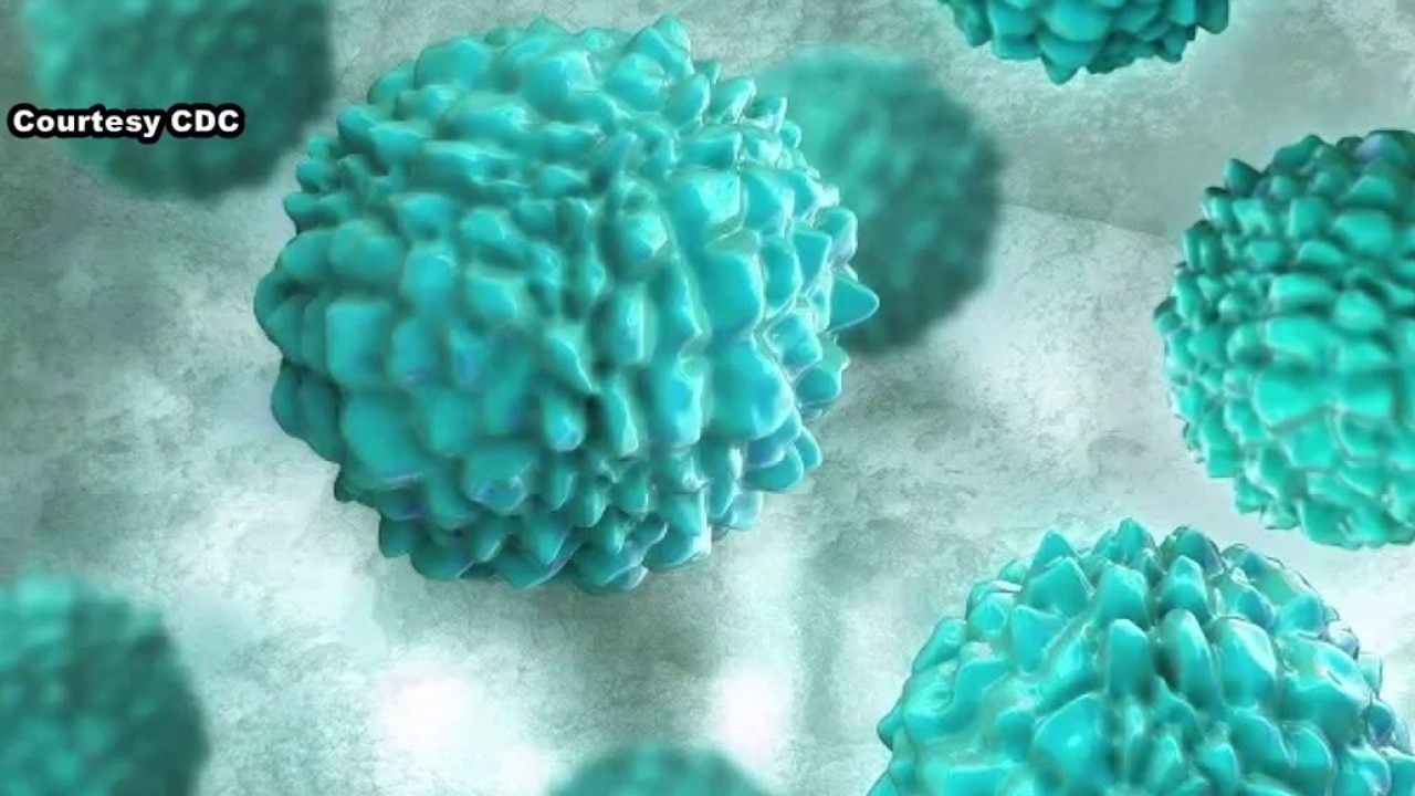 Parasitic outbreak spreading across U.S.