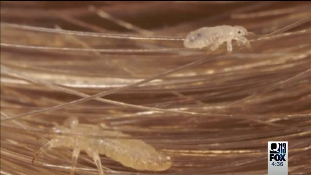 Some parents upset about Bellingham School Districts policy on students with head lice