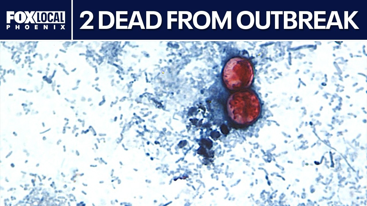 Cyclospora: Parasite outbreak blamed for 2 deaths