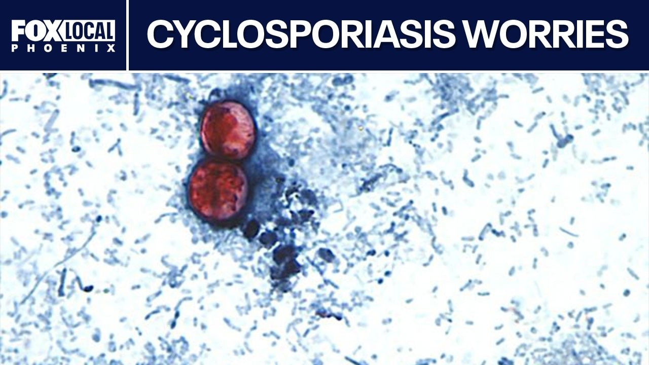 Cyclosporiasis: Arizonans react to multi-state outbreak