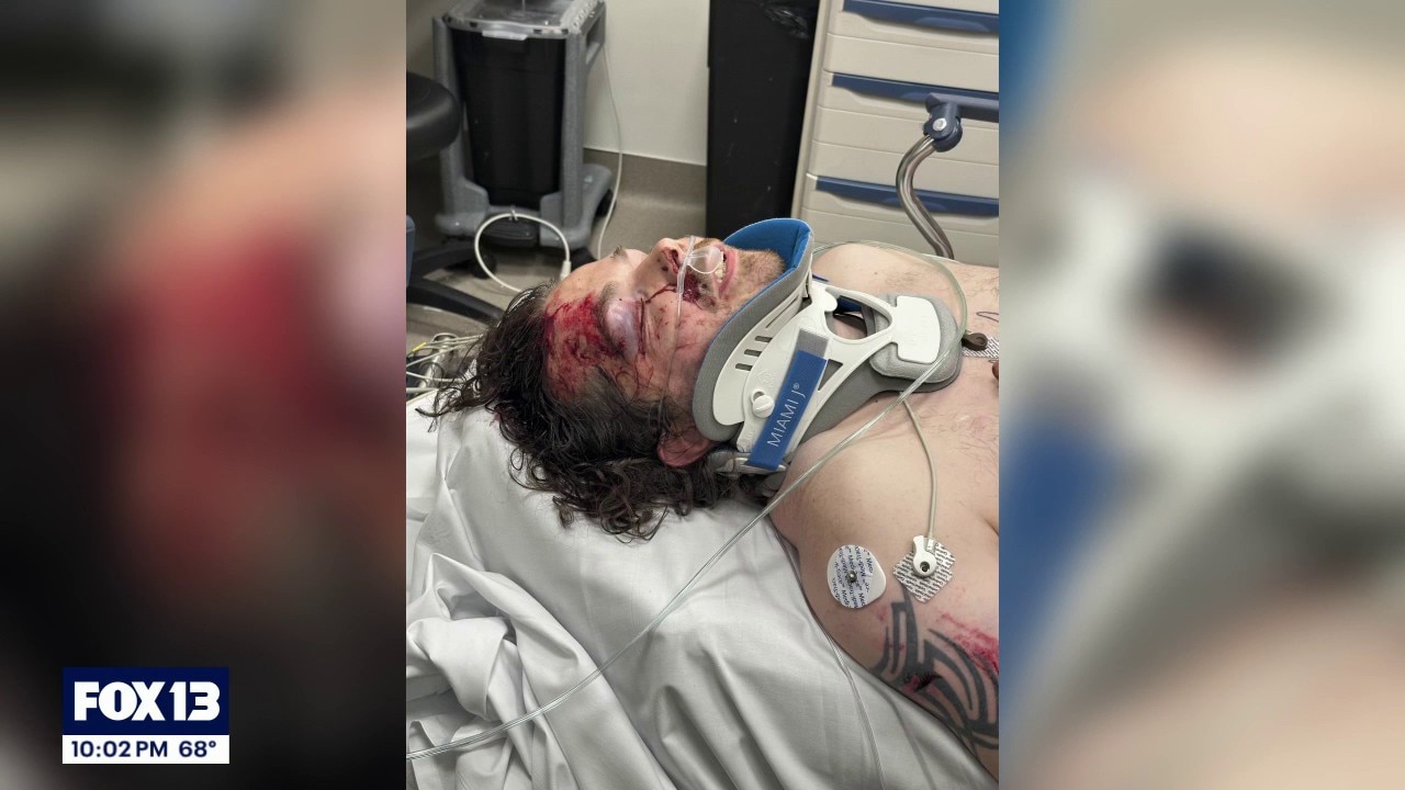 Newlywed fighting for his life after e-scooter, bus crash
