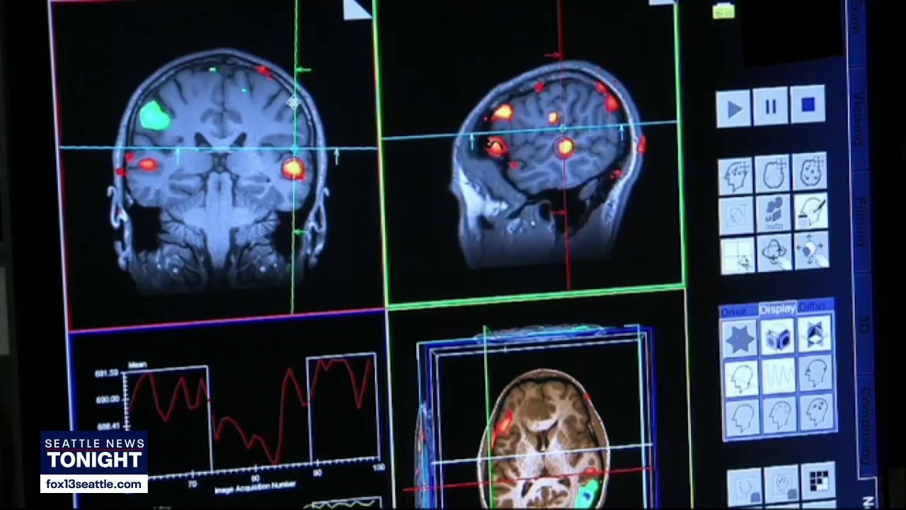 New experimental drug shows breakthrough in Alzheimer's