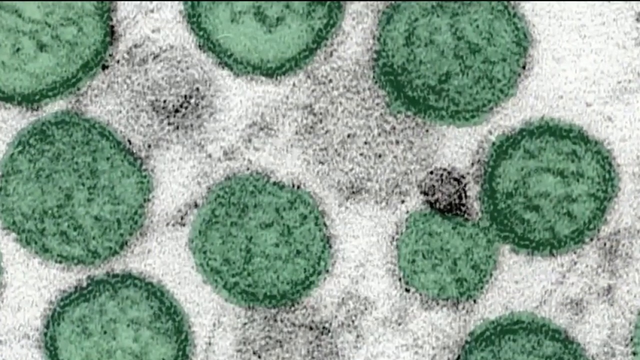 Georgia doctors track cruise ship virus outbreak
