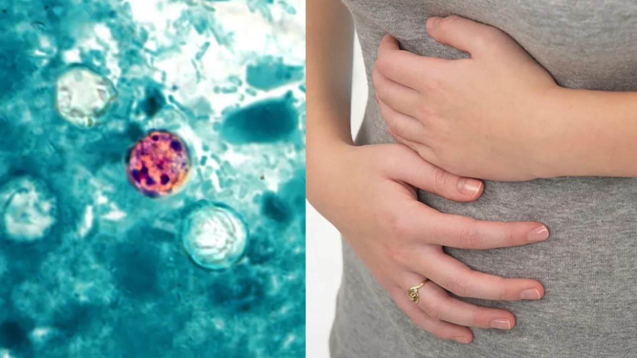 Illinois doctor explains what to know about the 'explosive' diarrhea parasite