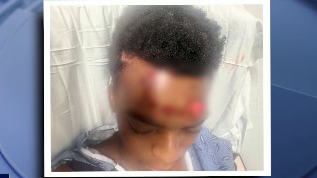 DeKalb mother begs for answers after son hit while on skates
