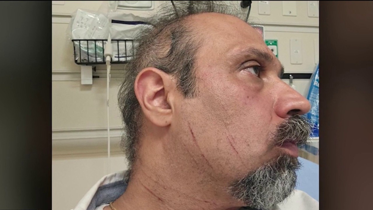 Atlanta driver survives savage ambush after posting criticism of Iranian regime