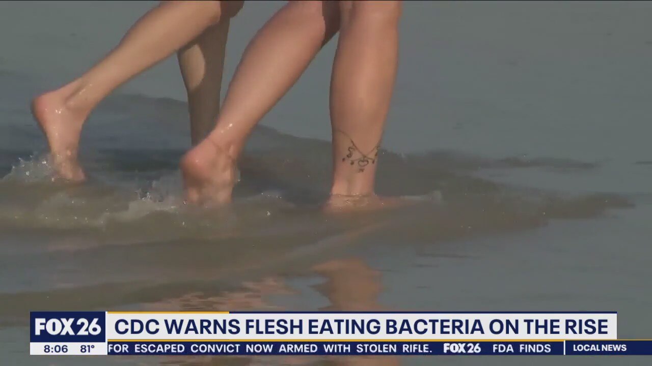 CDC Warns flesh eating bacteria on the rise !