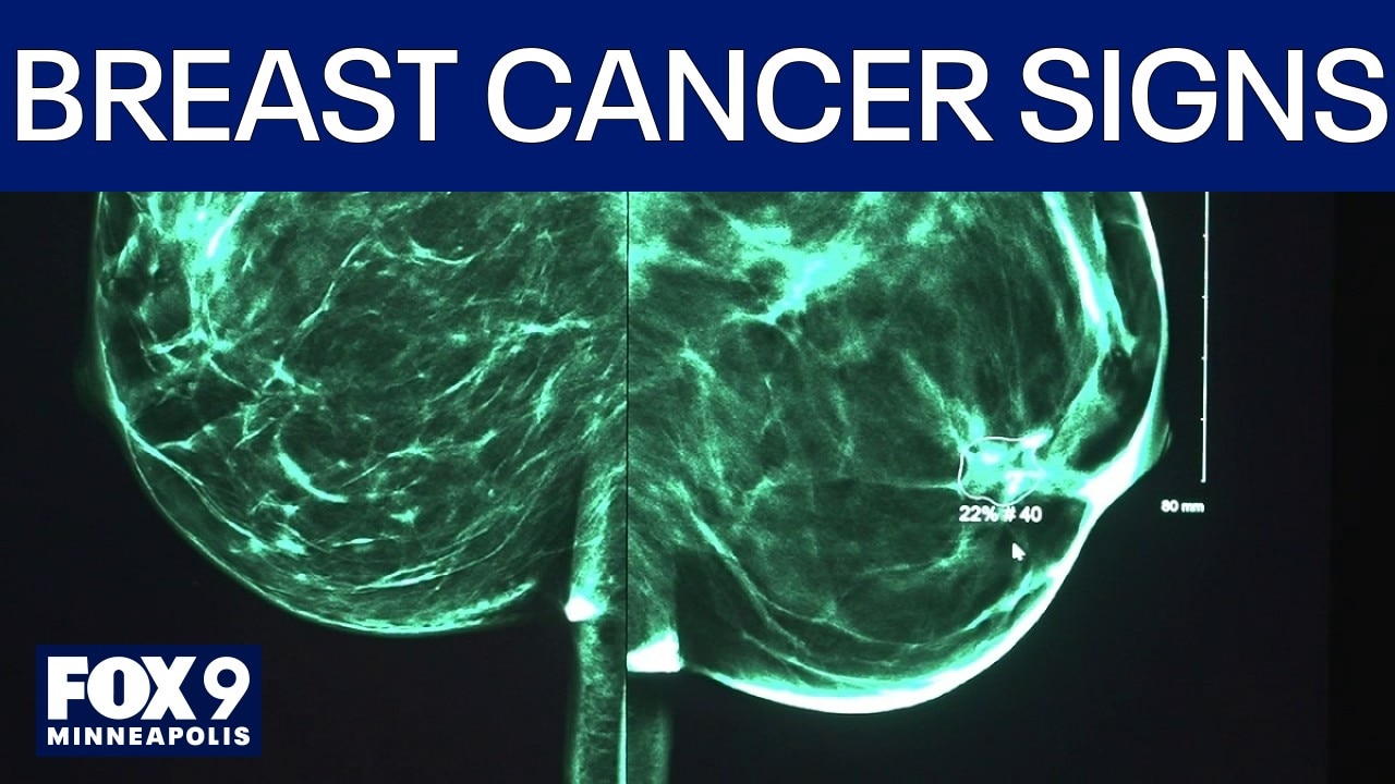 Beyond the Pink: Knowing the symptoms and warning signs of breast cancer