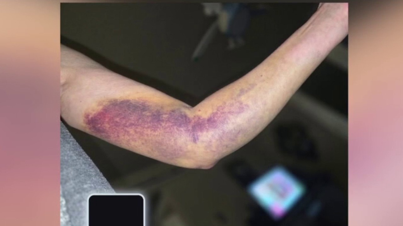 Lago Vista road rage assault victim speaks out