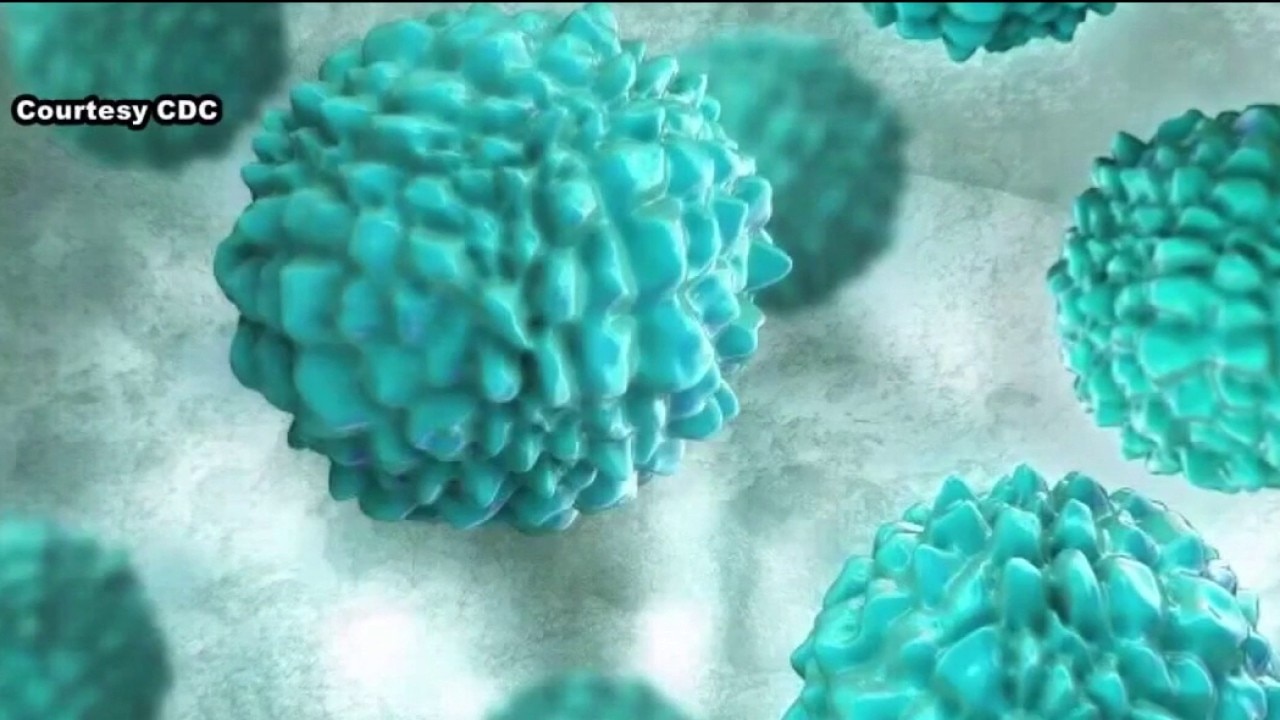 Cyclospora outbreak now linked to Illinois, 3 other states