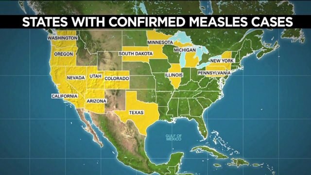 We could learn more as soon as Monday about two suspected cases of measles in Portage County