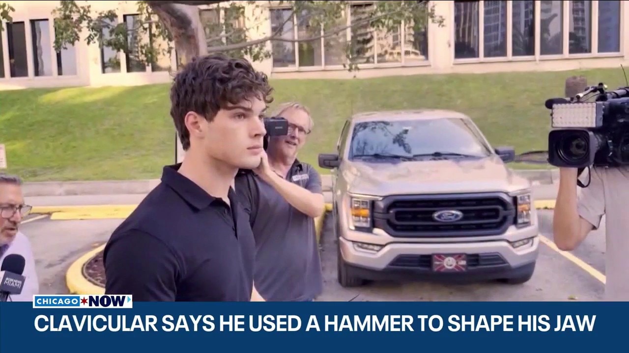 TMZ: ‘Looksmaxxing’ influencer Clavicular says he used hammer to reshape jaw | ChicagoNOW