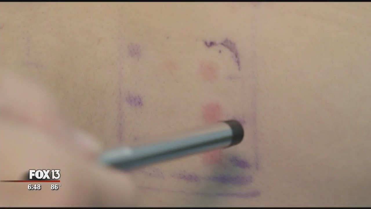 The truth about sunscreen and skin cancer