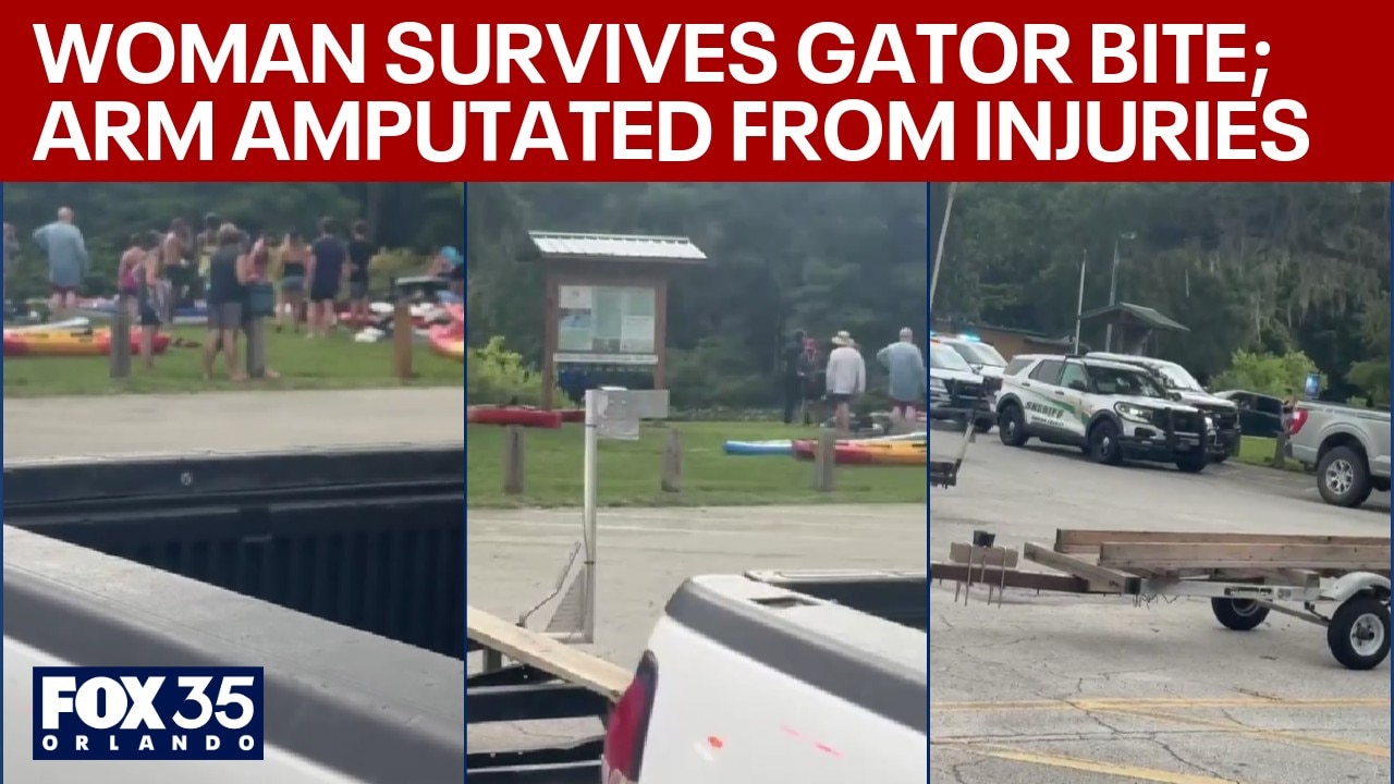 Woman survives alligator bite in Marion County Silver River; arm amputated, family says