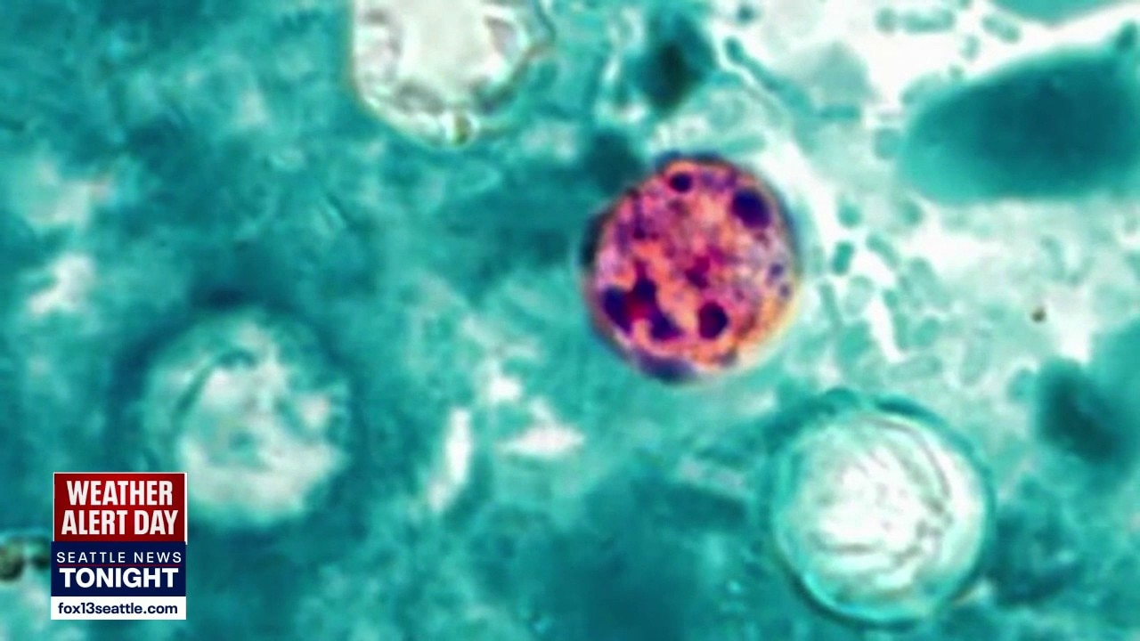 Tips for avoiding the cyclosporiasis parasite