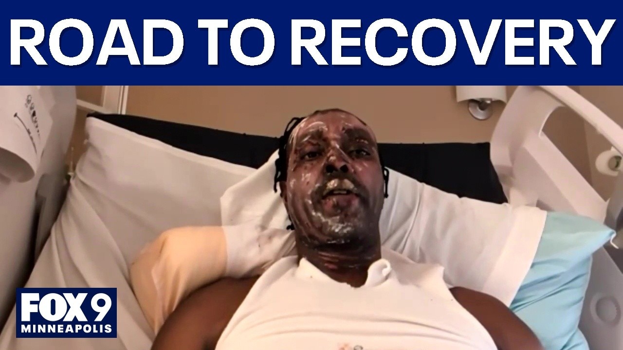 Food truck owner recovering after explosion