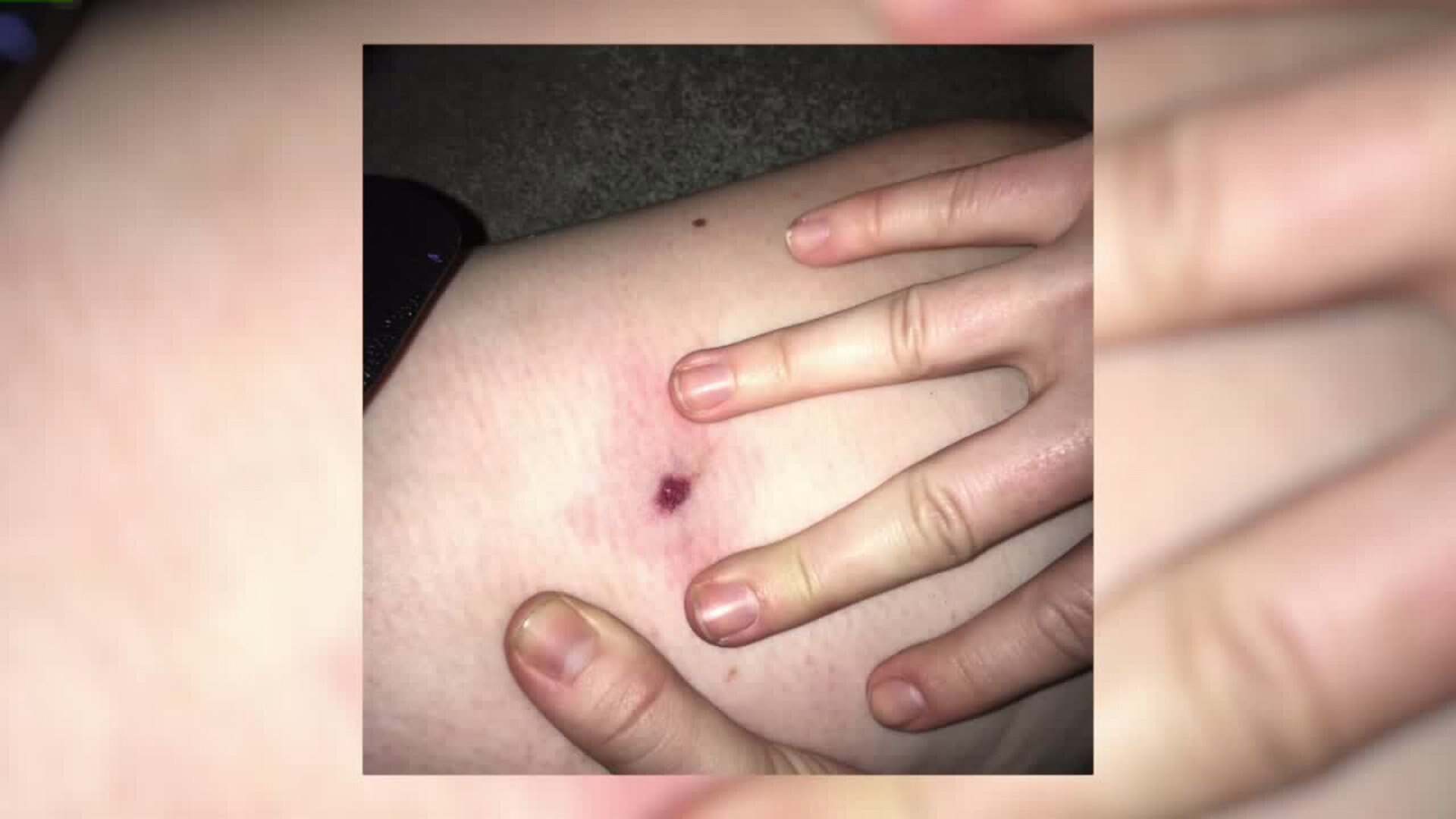 Bicyclist hit by BB in the leg