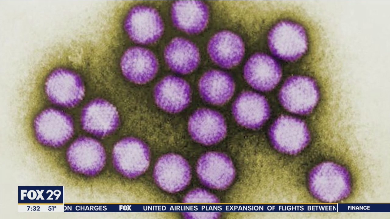 CDC issues warning about rising cases of acute hepatitis