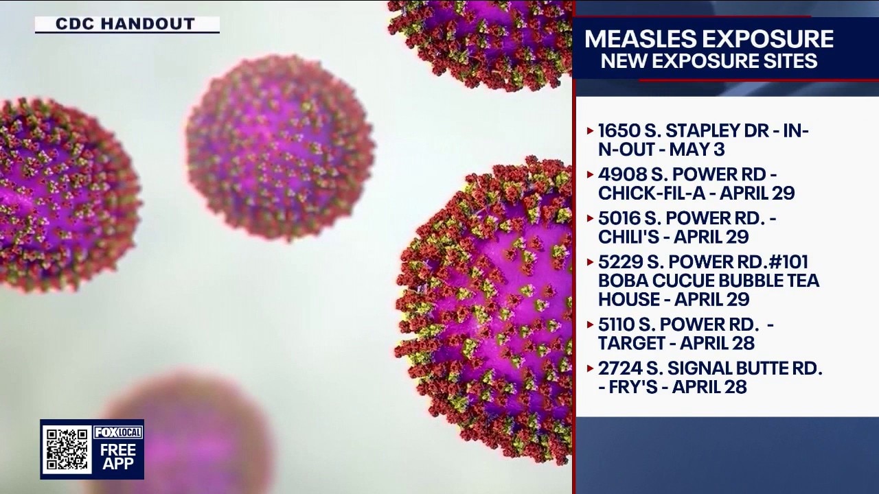 3 new measles cases reported in the East Valley