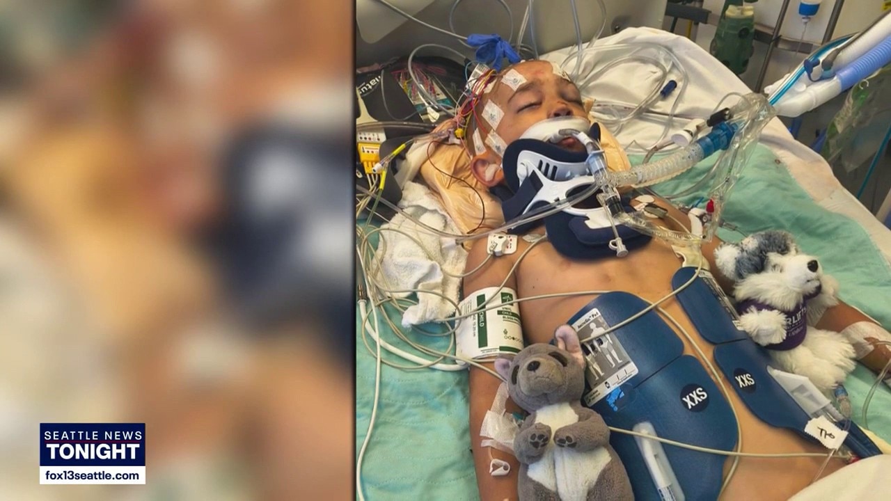 Beach driftwood collapse injures 6-year-old boy