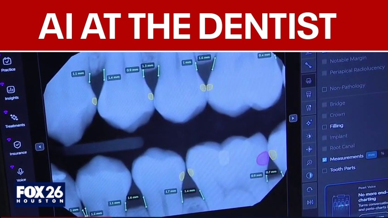 How AI in dentistry is transforming smiles