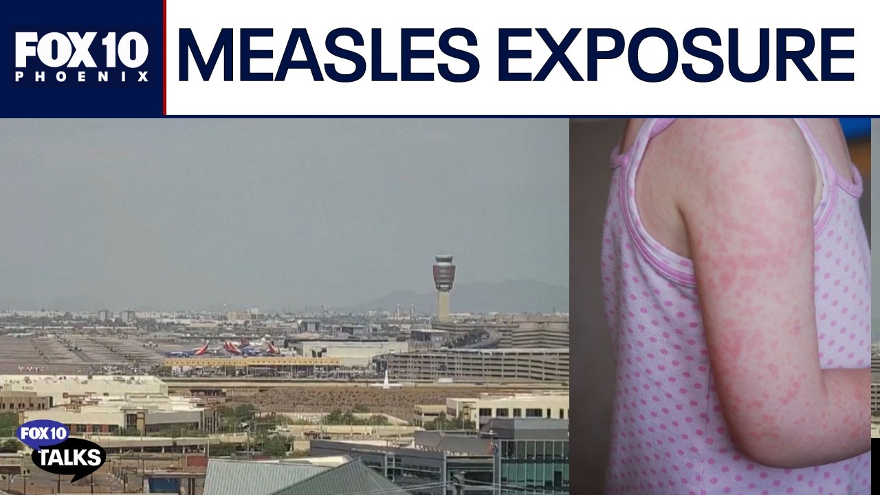 Measles exposure at Phoenix Airport: Doctor breaks down the risk | FOX 10 Talks