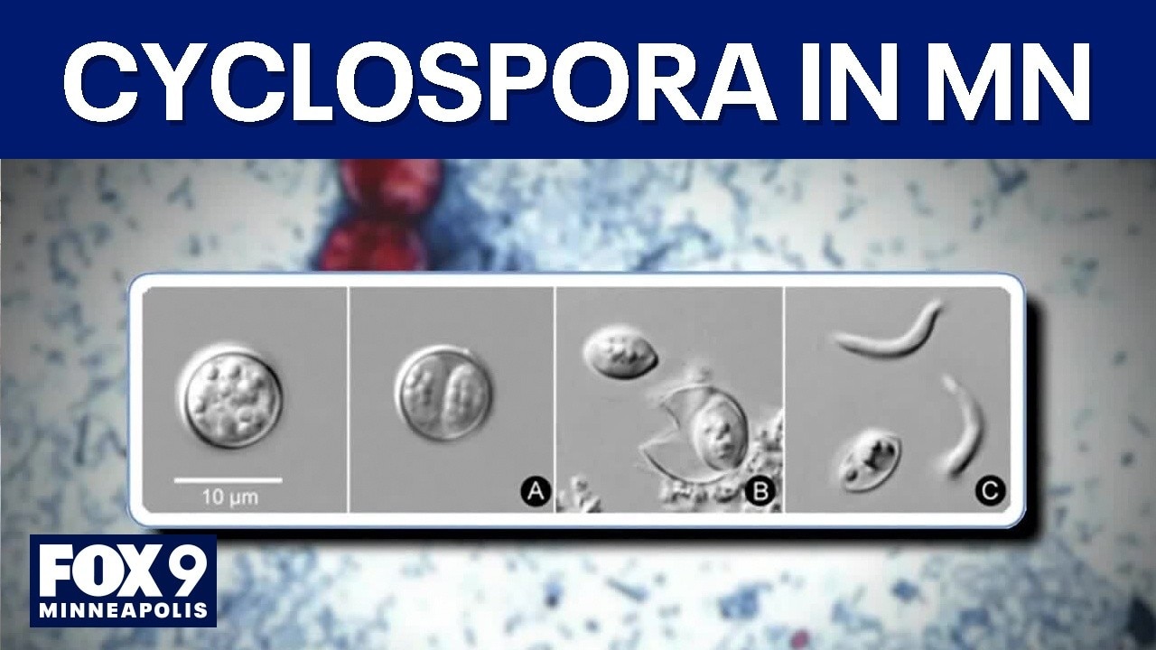 What to know by about Cyclospora in MN