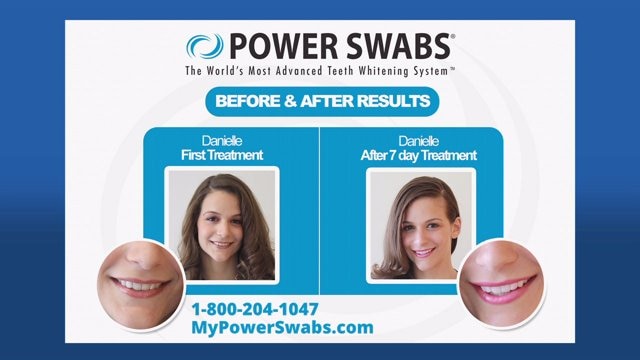 FOX Focus: Learn about Power Swabs, a revolutionary teeth whitening system