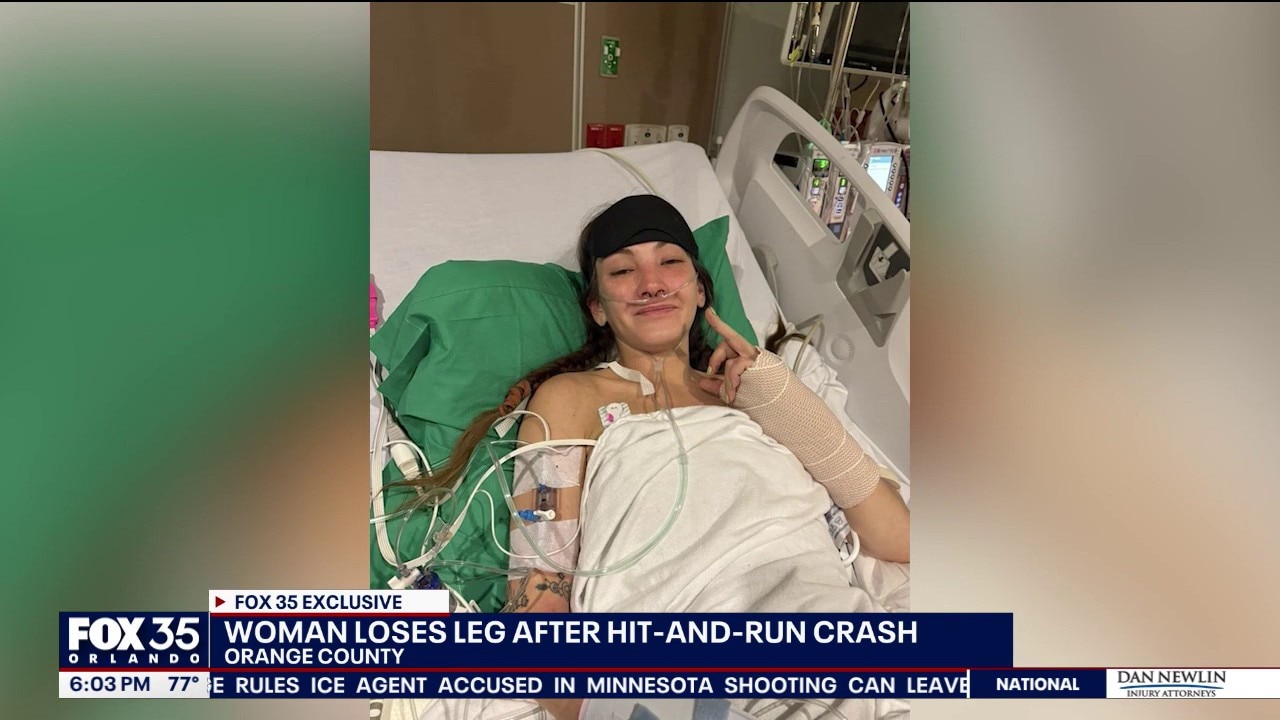 Woman pulled over on Colonial Drive loses leg after being struck by hit-and-run driver