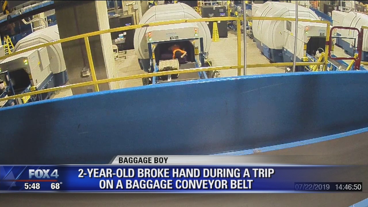 2-year-old breaks hand riding on baggage conveyor belt