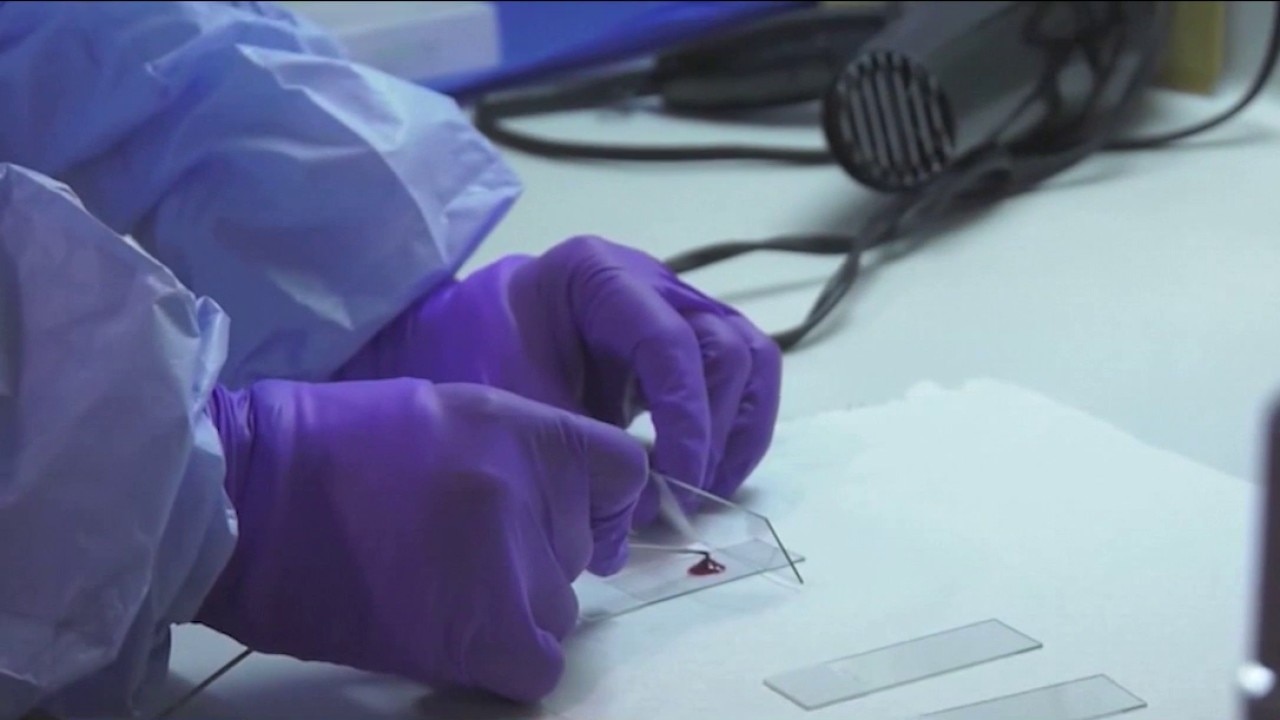 Pancreatic cancer: FDA approves new drug