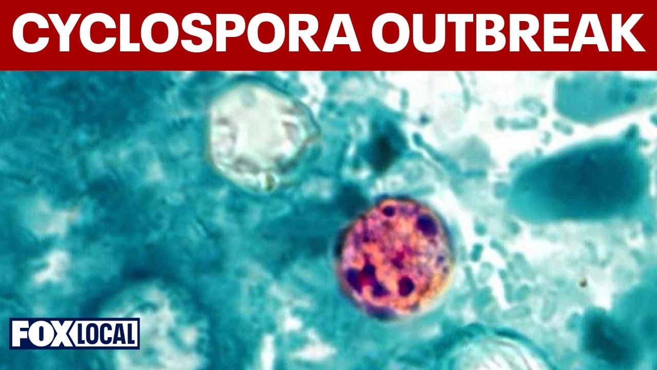 Massive cyclospora outbreak sickens thousands as CDC searches for source