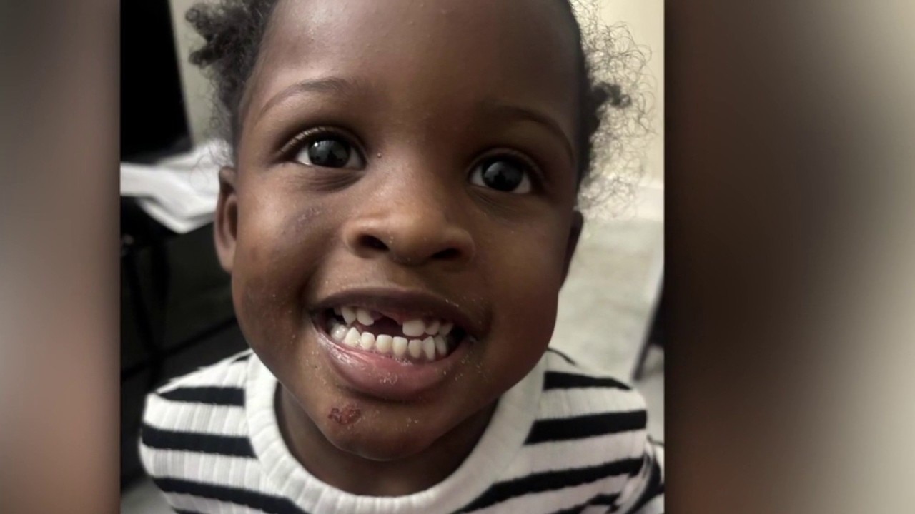 Mother wants answers from daycare about 3-year-old's missing tooth