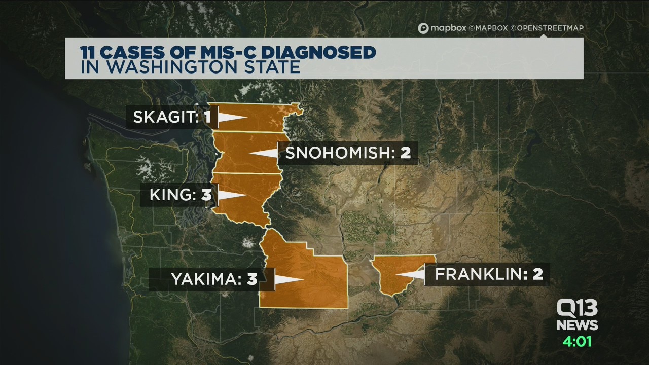 Washington state reports 11 cases of inflammatory pediatric syndrome