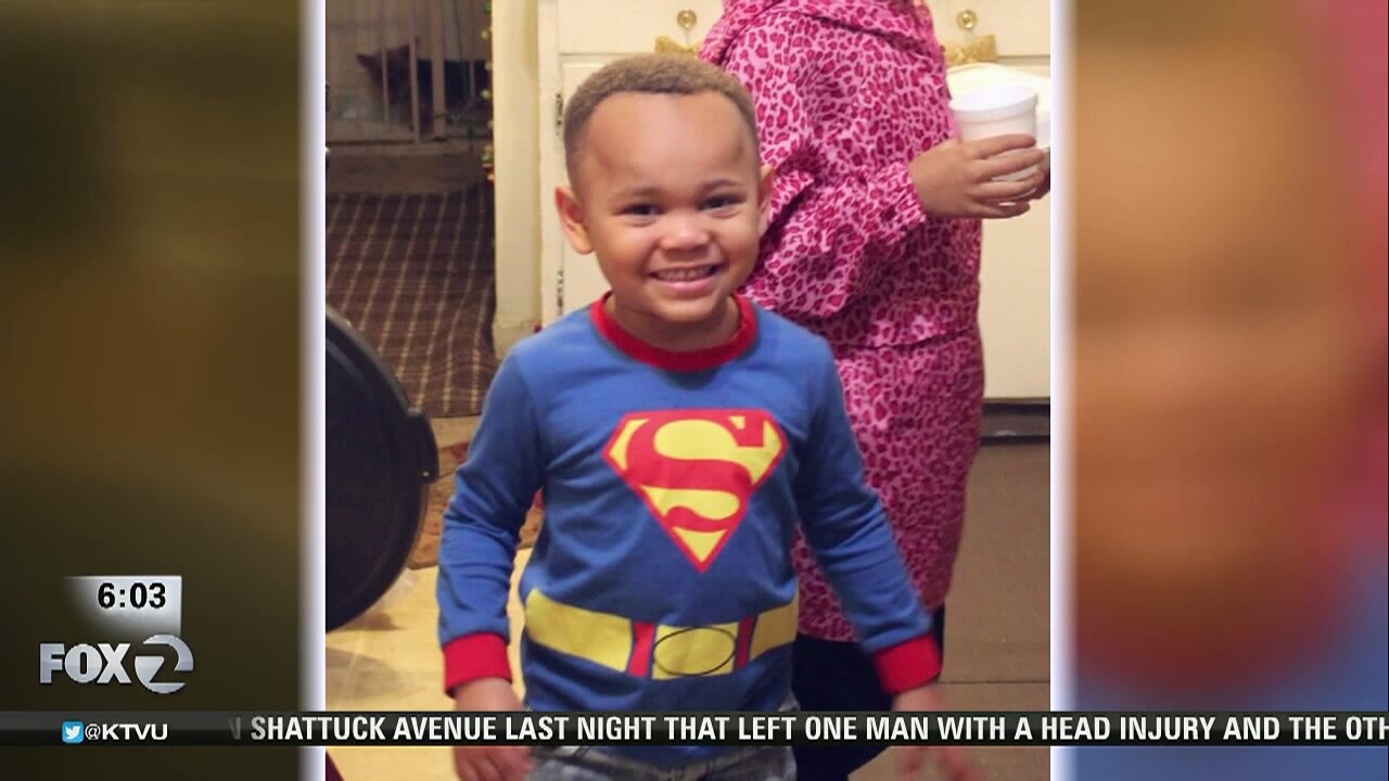 4-year-old shot in the head