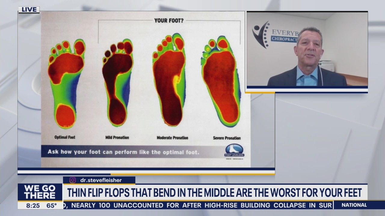 How those summer flip-flops can negatively impact your feet