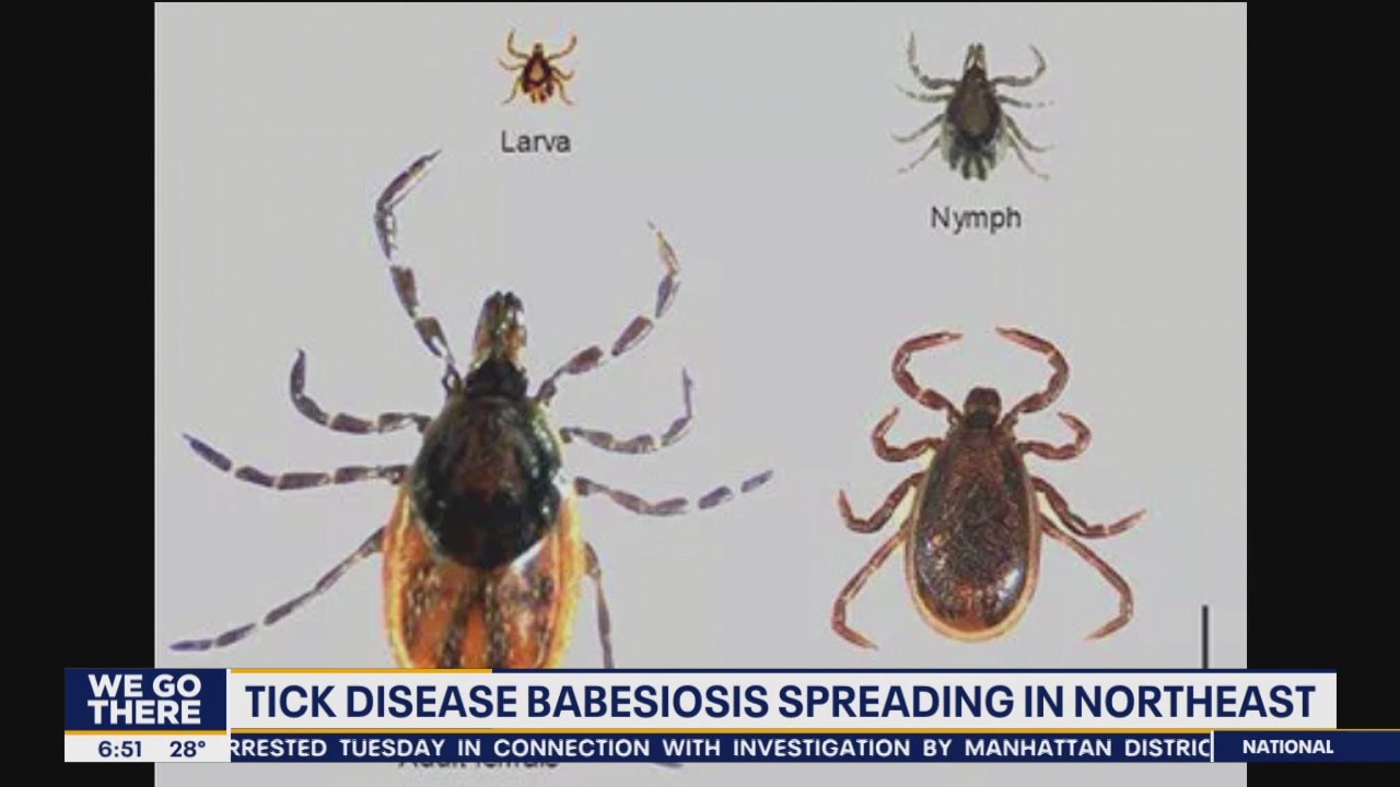 Health Watch: Tick disease spreading in Northeast