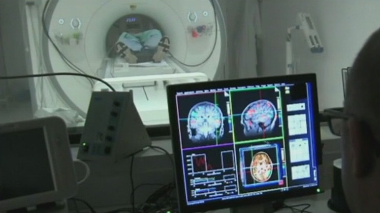 Big decision on experimental Alzheimer's drug