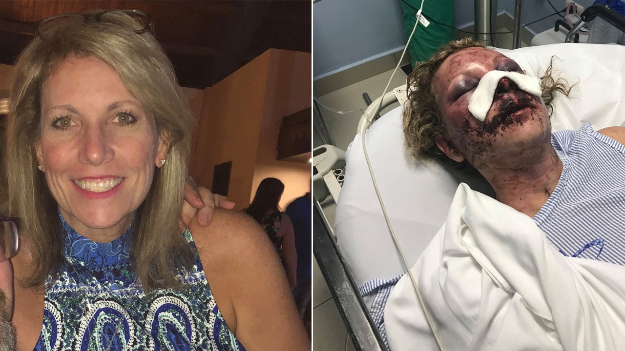 Woman shares story, photos after being severely beaten allegedly by resort employee in Punta Cana