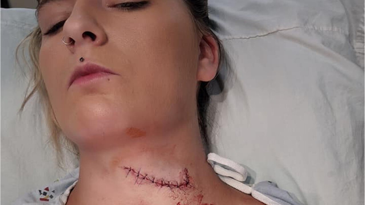 Women survives freak lawn mower accident that left her neck sliced open