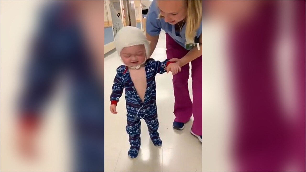 Video of 23-month-old son walking days after intensive skull surgery