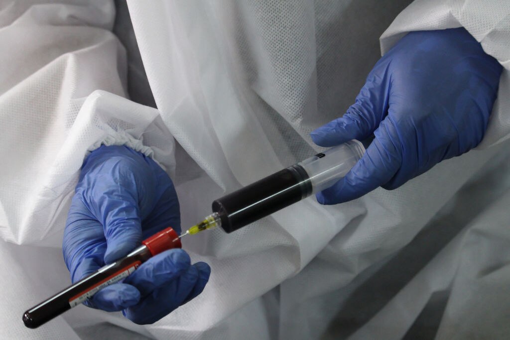 Recovered COVID19 plasma needed due to short supply